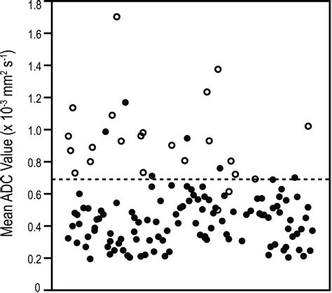 Distribution Of Apparent Diffusion Coefficient Adc Values In Benign