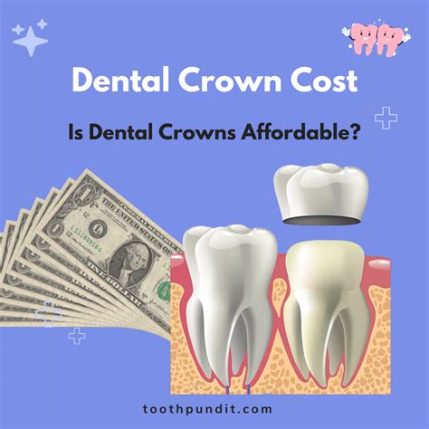Dental Crown Cost Is Dental Crowns Affordable For Everyone