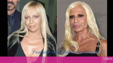 Donatella Versace Antes E Depois Das Cirurgias FlashVidas Vidas