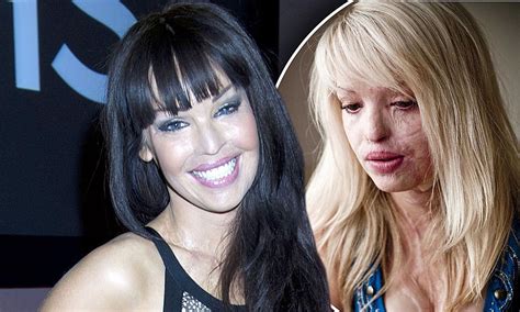 Katie Piper Story Acid Attack Survivor Pens Self Help Book Daily Mail Online