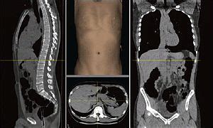 BBC News HEALTH US Doctors Offer Full Body Scan