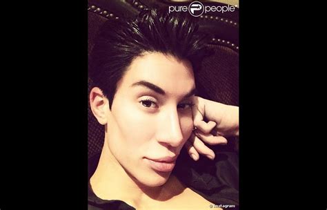 Justin Jedlica Le Ken Humain Accro à La Chirurgie Déteste La Barbie Humaine Purepeople