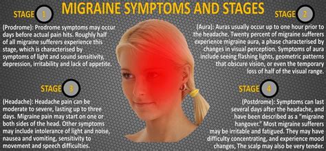 Migraine Symptoms And Stages Migraine Severe Headache Migraine Aura