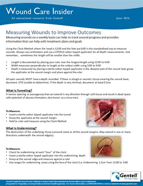 Wound Drainage Assessment