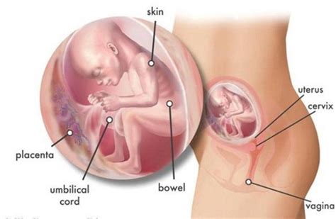 Metode ini jauh lebih aman dibandingkan mengakhiri kehamilan. Artikel Bentuk Janin Usia 4 Bulan - Berbagi Bentuk Penting