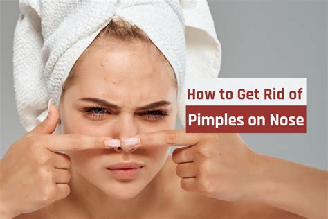 Acne is a very common skin condition that can appear almost anywhere on your body. How To Get Rid Of Pimples On The Nose - 5 Natural Remedies ...