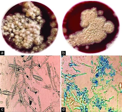 Isolated Dermatophytes On Dermatophyte Test Media After 17 Days At