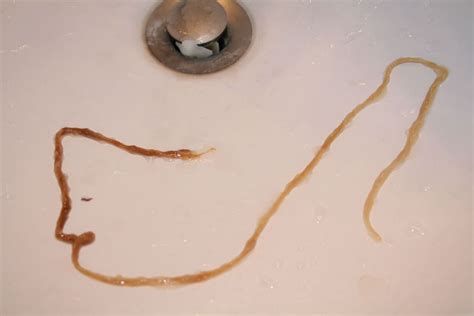 Please Help With Parasite Identification Photos Included At Parasites