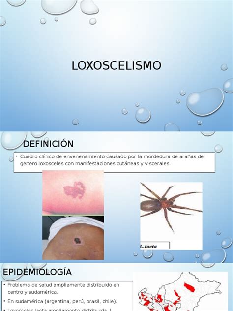 Loxoscelismo Diseases And Disorders Medical Specialties