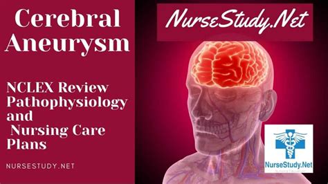 Cerebral Aneurysm Nursing Diagnosis And Nursing Care Plan Nursestudynet