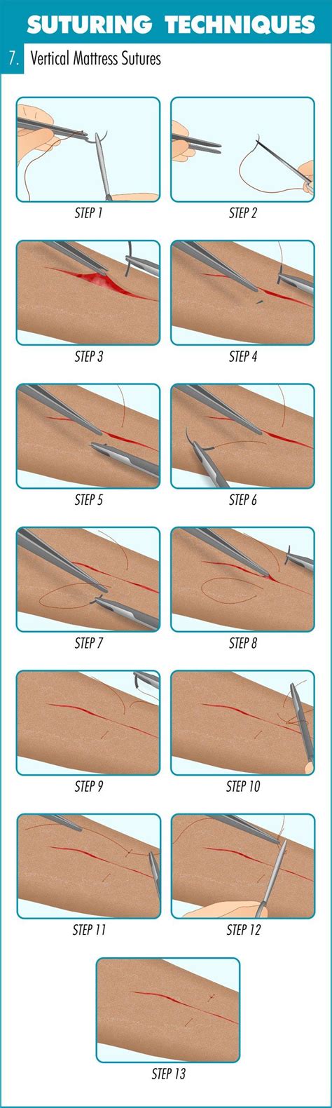 This Infographic Guide Runs You Through An Introduction To Suturing