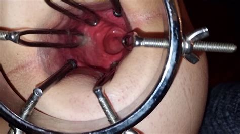 Deep View Into My Anal Tunnel Asshole Spreader Gay Porn A Xhamster