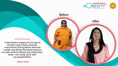 Bariatric Surgery And Weight Loss Journey Of Mrs Dina Shah Ahmedabad