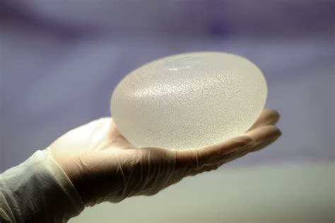 Reports Of Breast Implant Illnesses Prompt Federal Review The New
