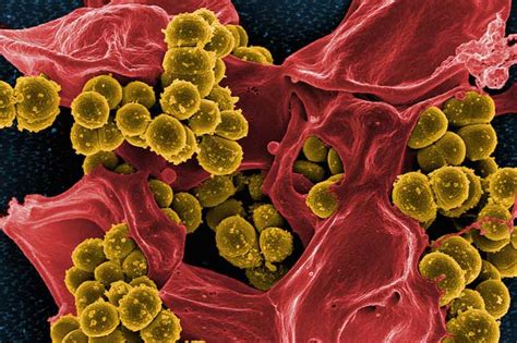 Researchers Identify Nasal Bacteria To Combat Staph Mrsa Gw Today