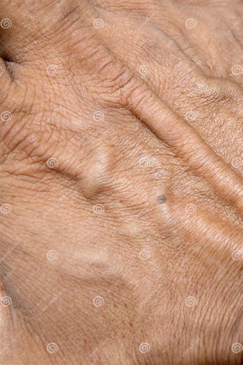 Close Up Of Veins Looks Protruding Male Hands Stock Image Image Of