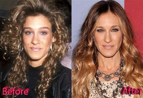Sarah Jessica Parker Before And After Rhinoplasty Procedure Nose Job