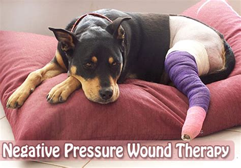 Negative Pressure Wound Therapy A Special Technique Of Wound Repair