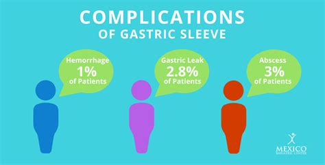 Gastric Sleeve Surgery Comprehensive Guide 2021 Vertical Sleeve