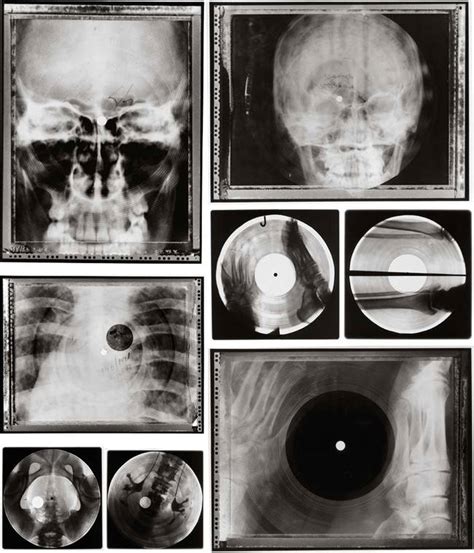 How Soviet Hipsters Saved Rock N Roll With X Ray Records Realm Blog