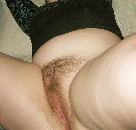 Pubic Hair 20 Pics Xhamster Hot Sex Picture