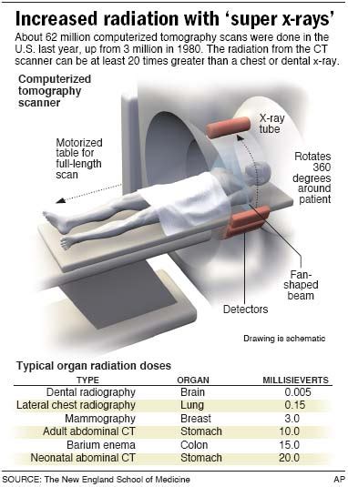 Radiation From Ct Scans