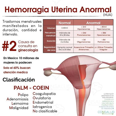 hemorragia uterina anormal causas estructurales palm hot sex picture