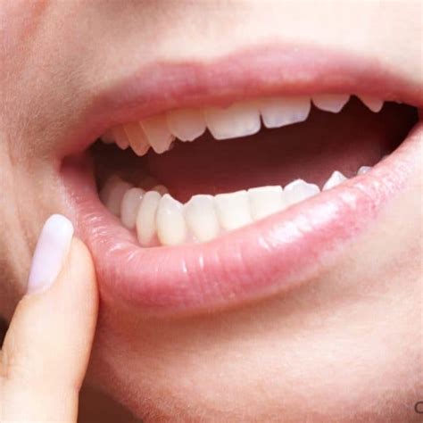After your teeth removal surgery, you should prepare a mouth rinse using warm water and salt. Invisalign Teeth Straightening Photos - Epsom Dentists