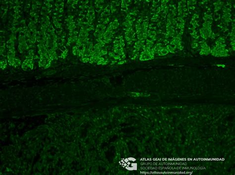 Pipeline for generating spinal cord atlas from electron microscopy. Células principales (Estómago de rata) Anti-Ribosomal P ...