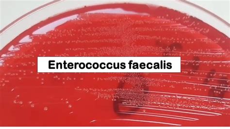 Enterococcus Faecalis Colony Morphology On Cled Agar Youtube