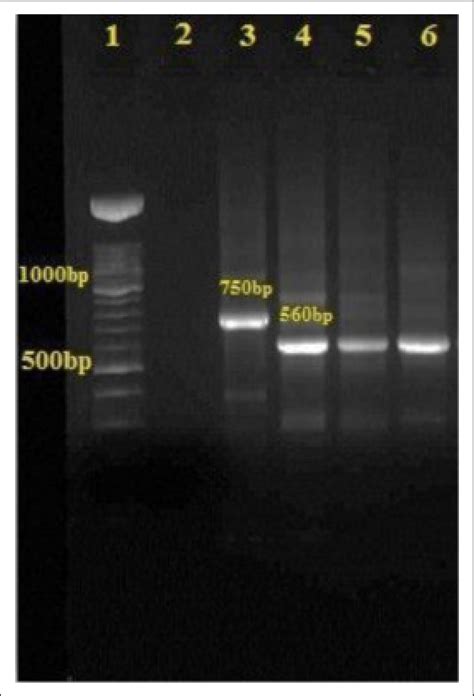 Agarose 15 Gel Electrophoresis Of Internal Transcribed Spacer Its