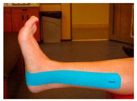 How To Kt Tape An Ankle For Support