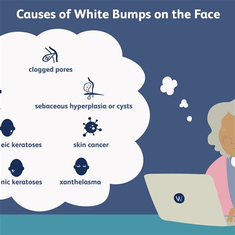 White Bumps On Face Not Milia Or Acne Milia Causes Removal And Expert