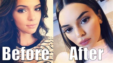 Kendall Jenner Totally Just Got Plastic Surgery She Looks Completely