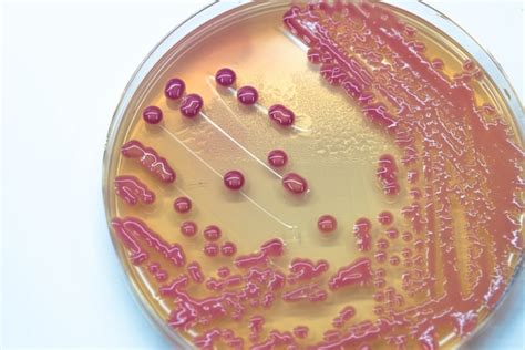 Cultivo De Colonias Bacterianas En Agar Agar En Microbiología Foto