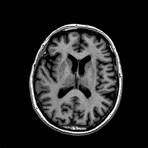 Looking At The Brain With Mri — Science Learning Hub