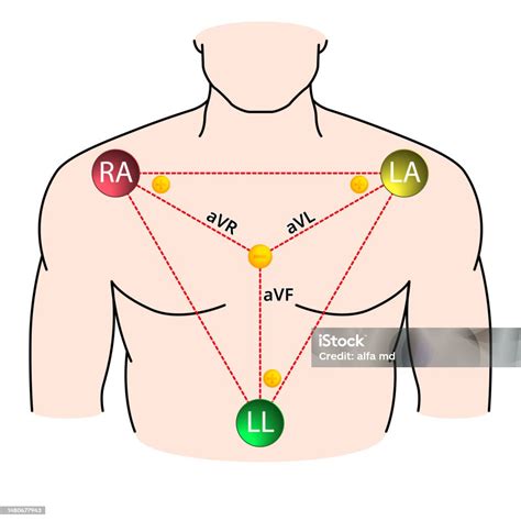 Augmented Limb Leads Ecg Einthoven Triangle Electrocardiogram Stock