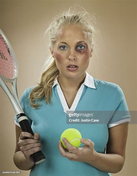 Female Tennis Player With Black Eye Holding Tennis Racket And Ball
