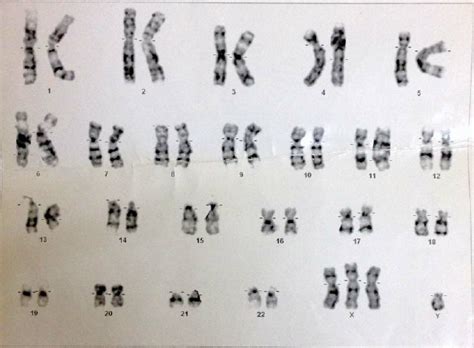 G Banded Karyotype Showing 48 Xxxy Pattern Download Scientific Diagram