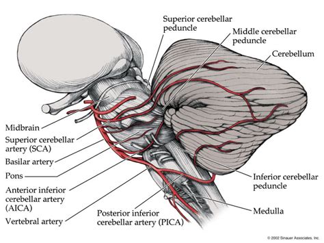 Posterior Inferior Cerebral Artery Pica Stepwards