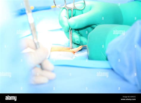 Open Hernia Surgery Stock Photo Alamy