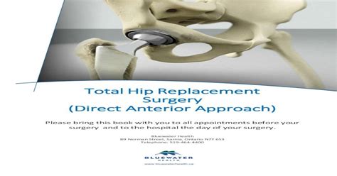 Total Hip Replacement Surgery Direct Anterior Approach · Hip Anatomy