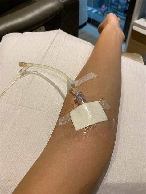 [Immunity Boost IV Drip Review] My Experience at Medical Spa LifeHub Hong Kong