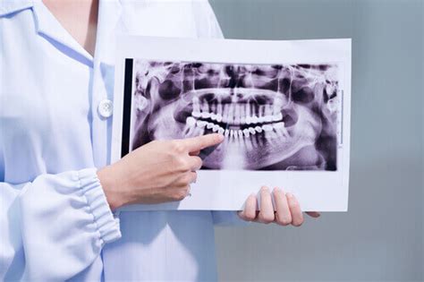 How Does A Dental Panoramic Radiograph Work Digital Dentistry