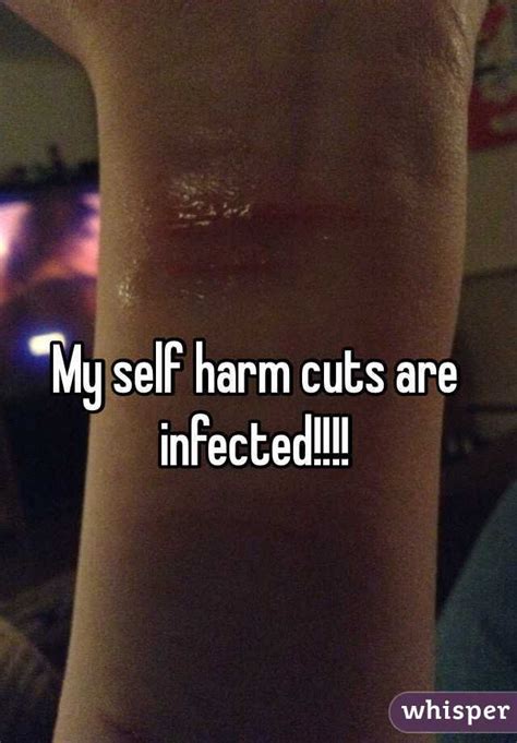 Also, while cuts and scrapes do hurt, if you have an infection you may also notice more more discomfort and/or pain around the wound than you would normally feel. My self harm cuts are infected!!!!