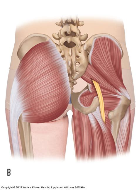 What Are The Signs Symptoms And Assessment For Piriformis Syndrome