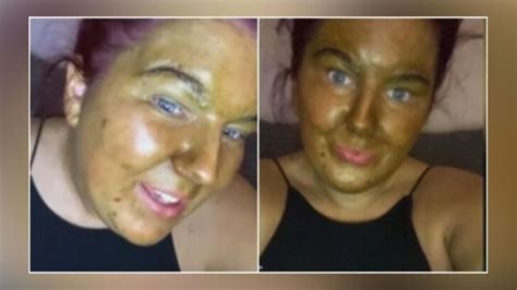 She Hulk Is Real Woman S Face Turns Green After Using Fake Tan On Pale