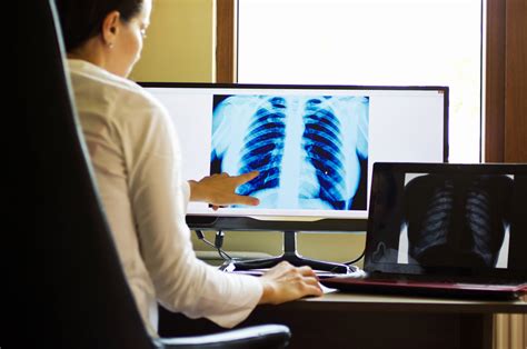 The Benefits of Implementing Digital Radiography ...
