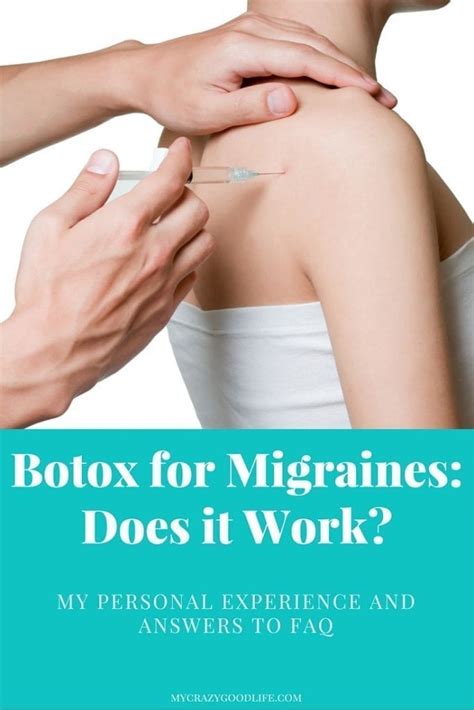 Botulinum toxin botox, experts believe, blocks a very specific type of neurotransmission that sends a signal from a even people like me, who don't get chronic migraines but do get a few horrific migraines a month. Botox for Migraines: Does it Work?