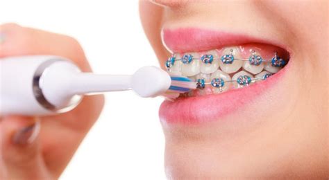 Swollen Gums With Braces What Does It Mean For Your Oral Health